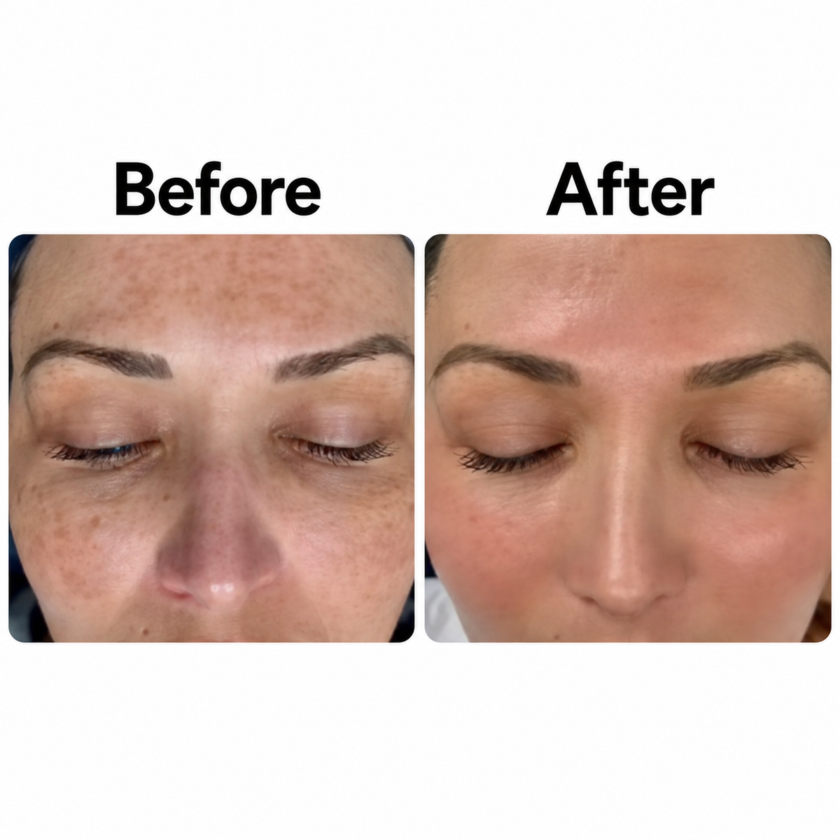 Kiro Select-Dark Spot Serum for Sensitive Skin