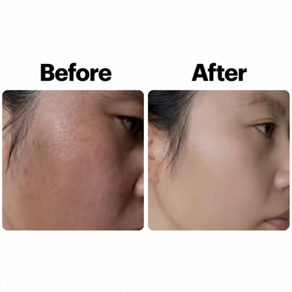Kiro Select-Dark Spot Serum for Sensitive Skin