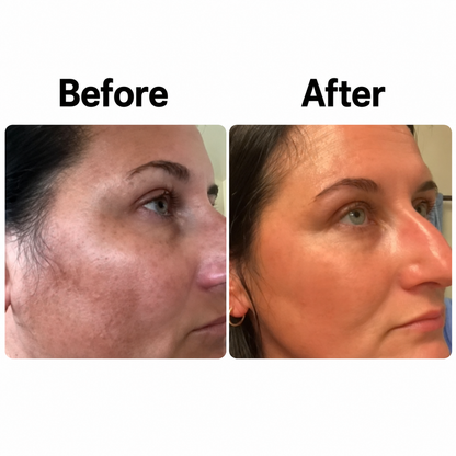 Kiro Select-Dark Spot Serum for Sensitive Skin